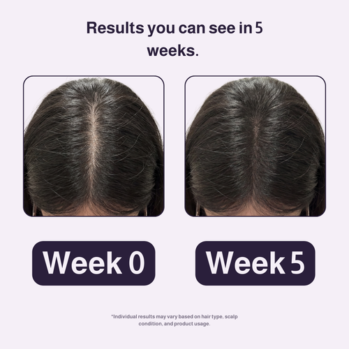 Belleaure Natural Collagen Strips: For Skin, Nails & Joint Support