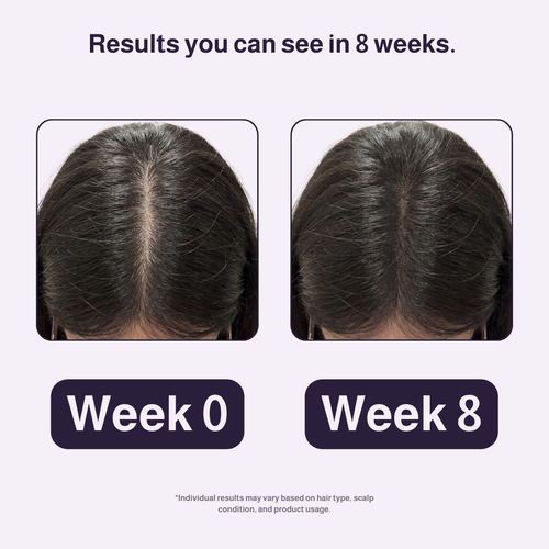 Belleaure Hair Support